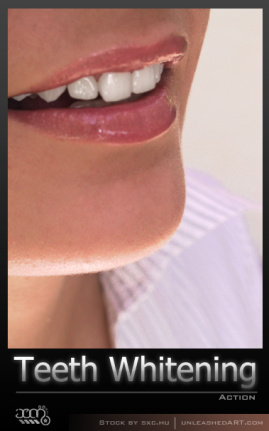 Teeth Whitening Actions